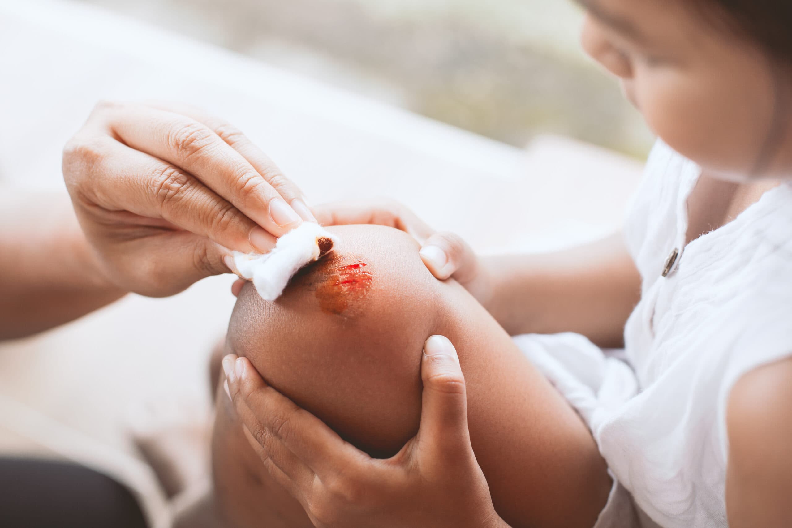 Parent helping her child perform first aid knee injury after she has been an accident